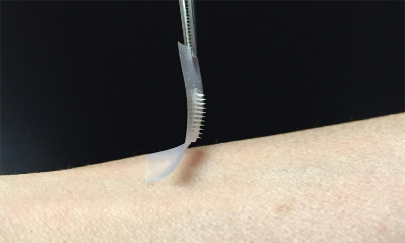 No More Injections Now Smart Patch Can Automatically Release Insulin Into The Bloodstream