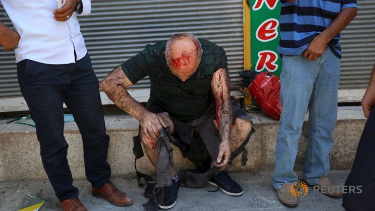 A wounded man pauses following an explosion in Suruc in southeastern Sanliurfa province Turkey