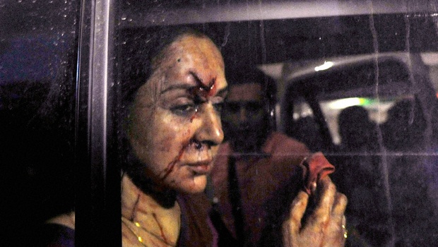 Hema Malini injured in a car accident near Jaipur