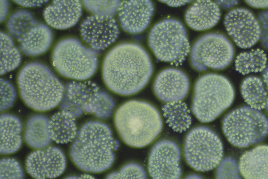 Cyanobacteria otherwise known as blue green algae