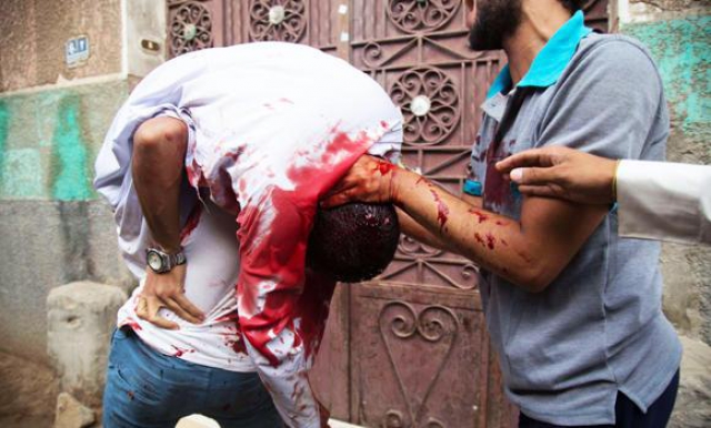 Festival turns bloody in Egypt