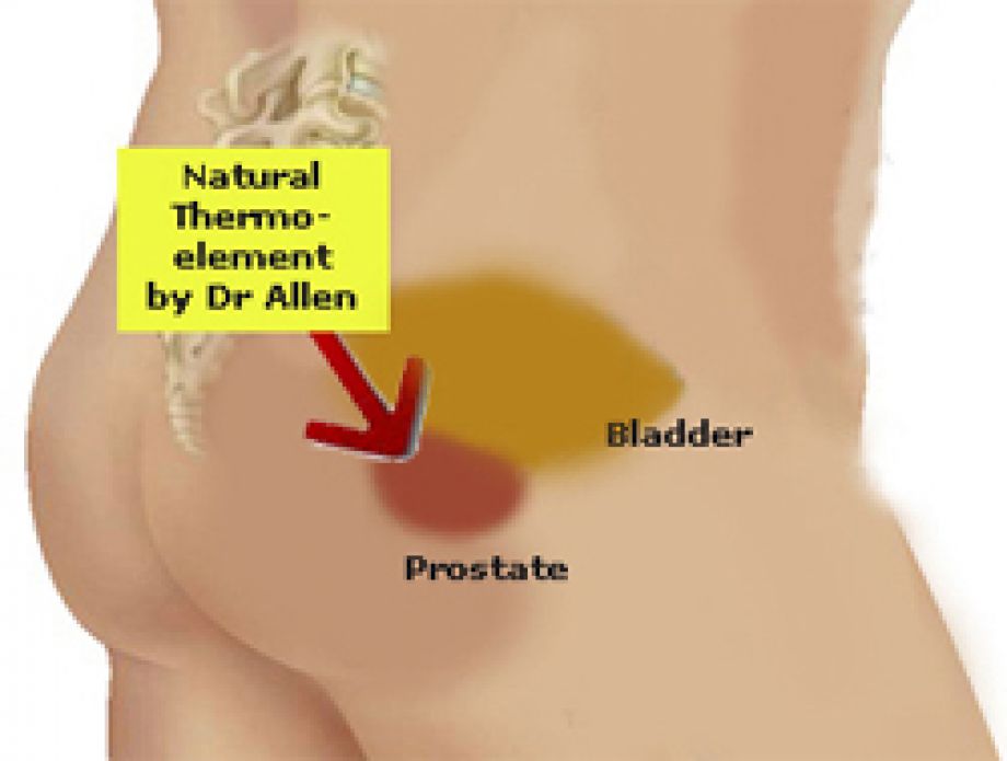 Expectant management of very low-, low-risk prostate cancer is effective, but