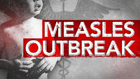 Washington reports first U.S. measles death in 12 years story image