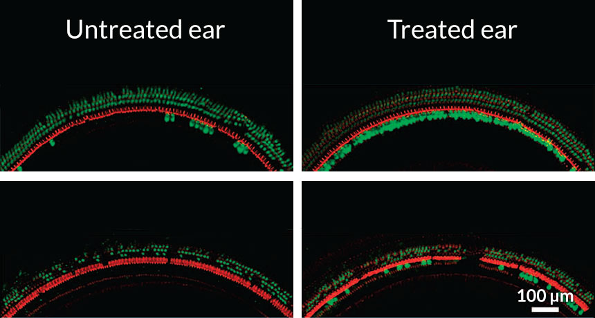 Gene therapy for deafness moves a few steps closer - Channel NewsAsia