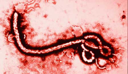 Liberia registers 2nd confirmed Ebola case