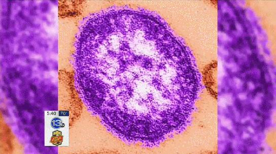 Wash. woman dies of measles; first U.S. death in 12 years | www.kirotv.com