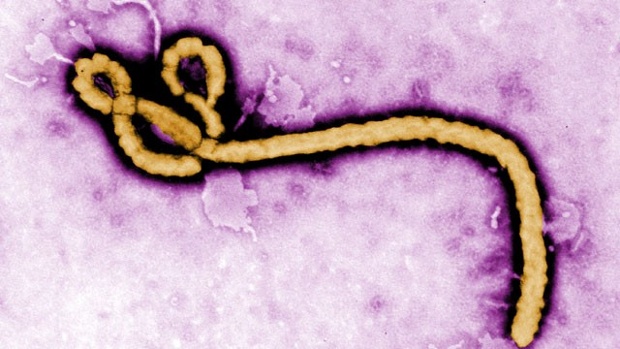 Ebola virus pink