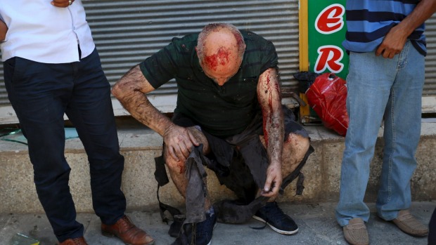 A wounded man sits on a step following an explosion in Suruc