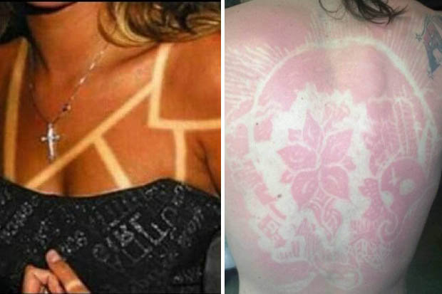 Sunburn Art Is Not Worth The Risks