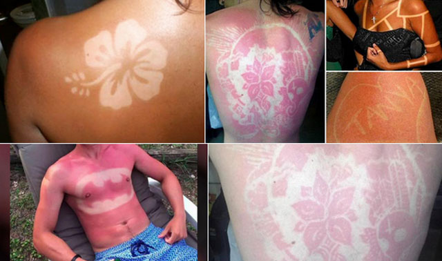 The hashtag #SunburnArt quickly caught on. From elaborate flower patterns to the Batman logo these designs resemble temporary tattoos but experts warn the habit is dangerous