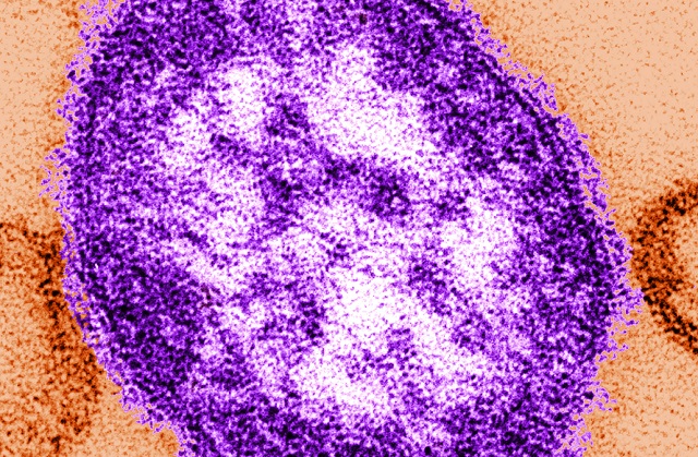 The Centers for Disease Control and Prevention shows an electron microscope image of a measles virus particle center