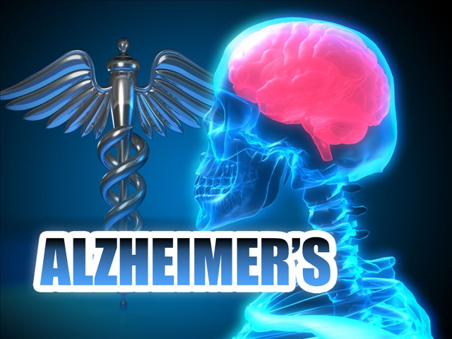 Alzheimer's Society comment on potential new symptomatic therapy for Alzheimer 