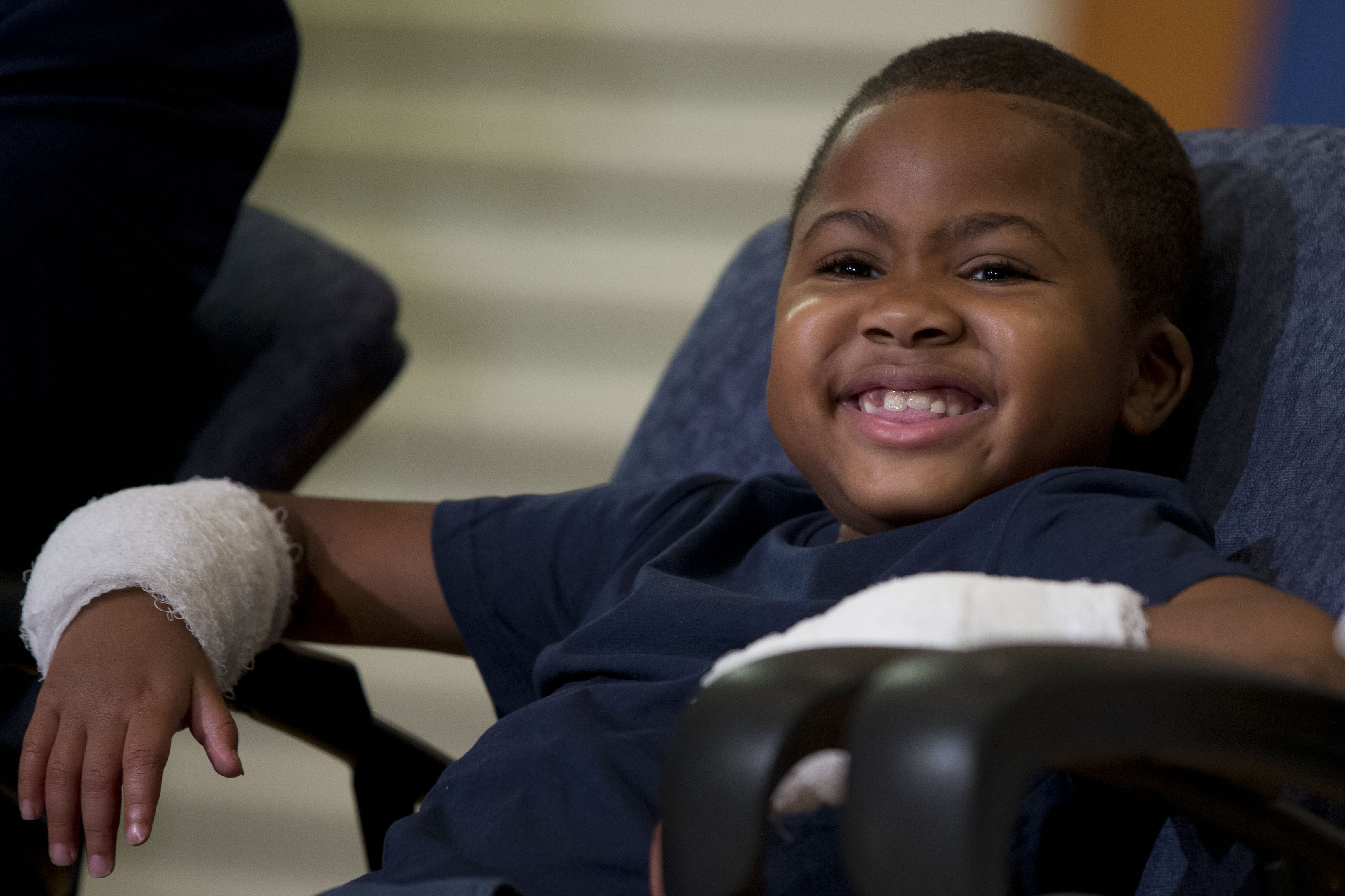 The Childrens Hospital of Philadelphia in Philadelphia. Surgeons said Harvey of Baltimore who lost his limbs to a serious infec