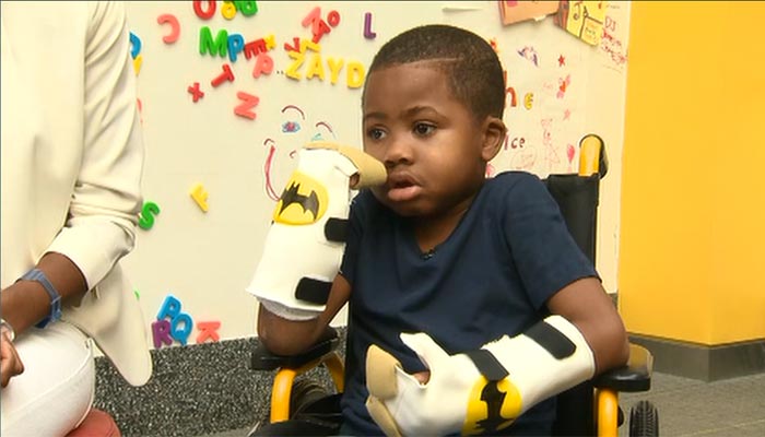 Zion Harvey 8 holds up his new hands which he received in a first-of-its-kind surgery