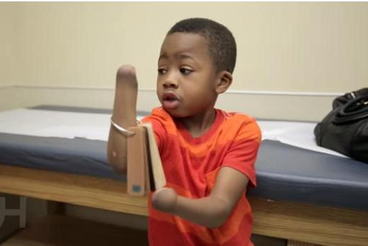 Boy who lost limbs to infection gets double-hand transplant - WTRF 7 News