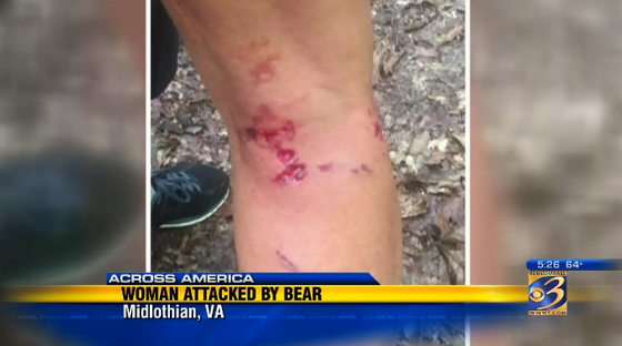 Virginia woman recounts attack by bear story image