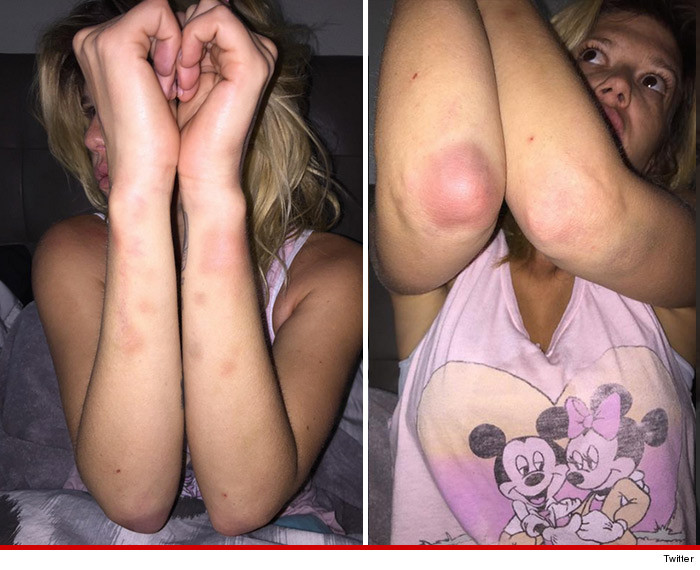 0805_chanel_west_coast_injuries_twitter