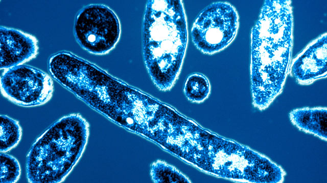 Health officials investigate 2 deaths amid Legionnaires' disease outbreak in