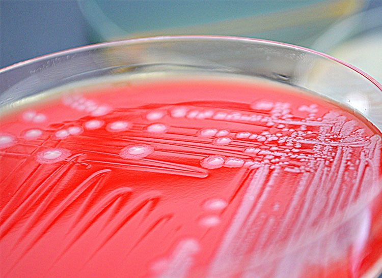 E. coli being grown in a petri dish