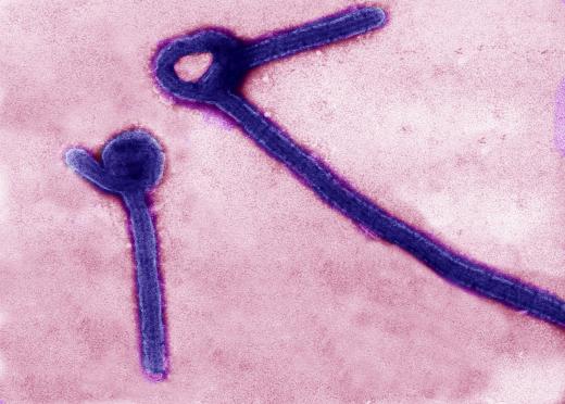 Image shows Ebola virus particles