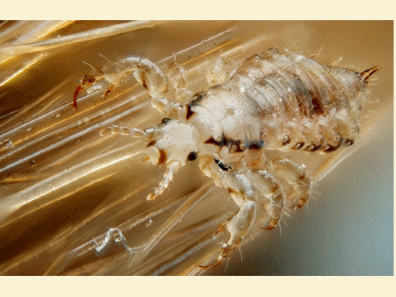 TreatmentResistant 'Super Lice&#039 Strike in California