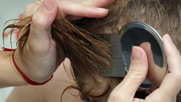 Head lice in Georgia Alabama and Florida have stopped responding to most overthecounter treatments But there are things parents can do at home to prevent the itch before it starts