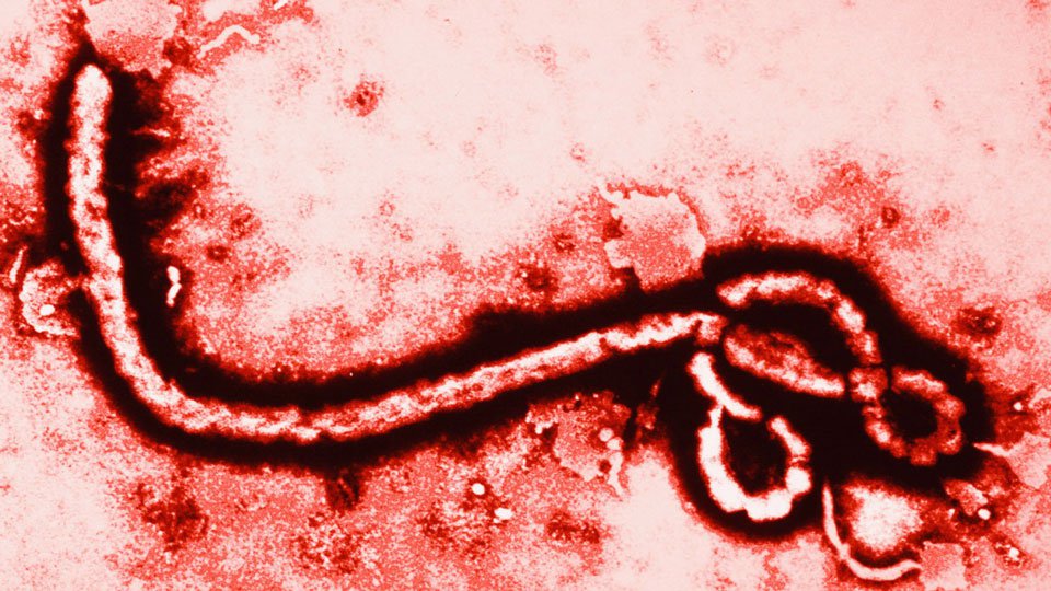 EBOLA-VIRUS