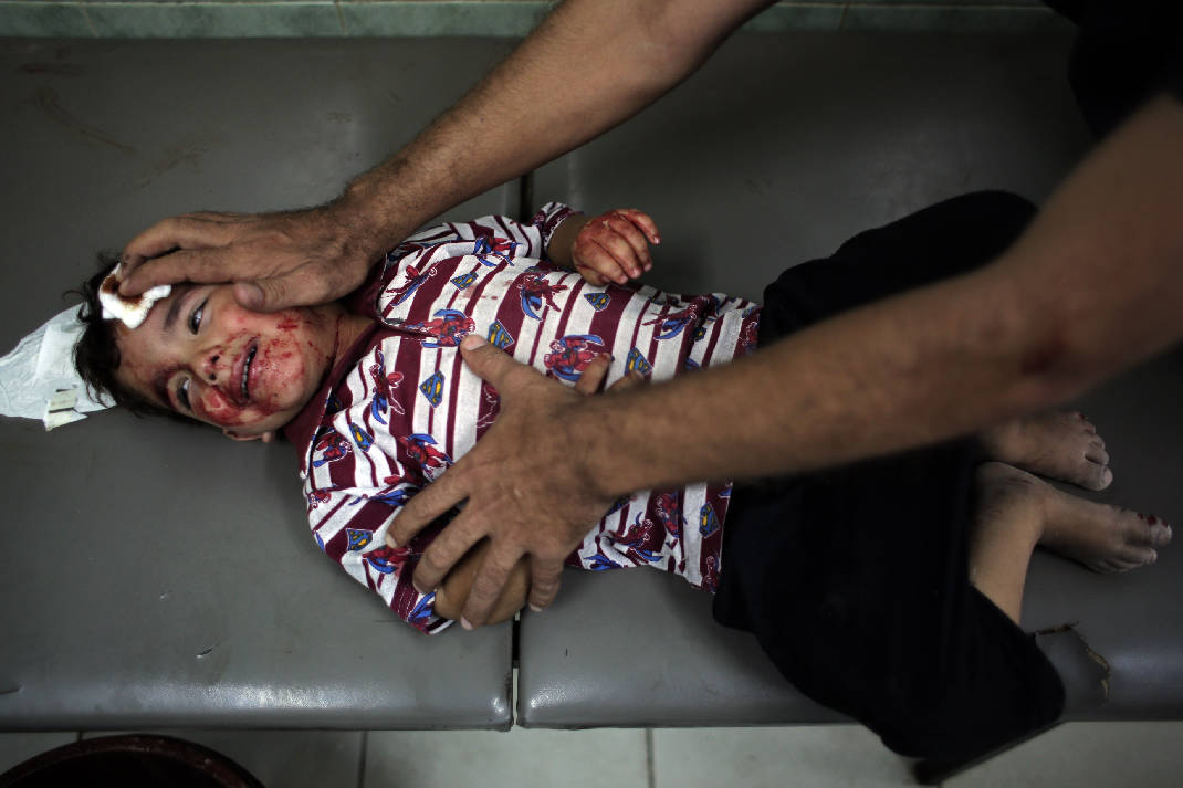 Palestinian toddler's father dies after arson attack