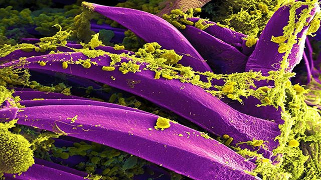 Purple-colored Yersinia pestis bacteria the bacteria that causes the plague seen on the spines of a flea. Credit National Institute of Allergy And Infectious Diseases