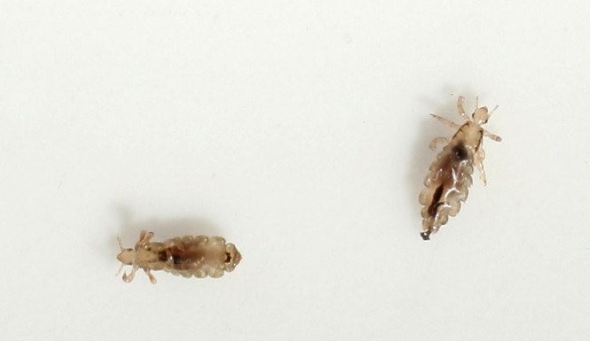 New 'super&#039 head lice develop resistance to treatment