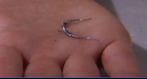 Safety being questioned for the birth control implant called Essure. It is an FDA approved implant that has come under fire from women complaining about side effects