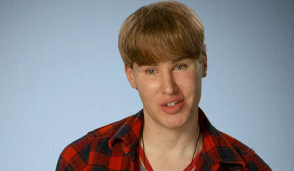 Tragic News Released About Man Who Payed Over $100000 to Look Like Justin Bieber