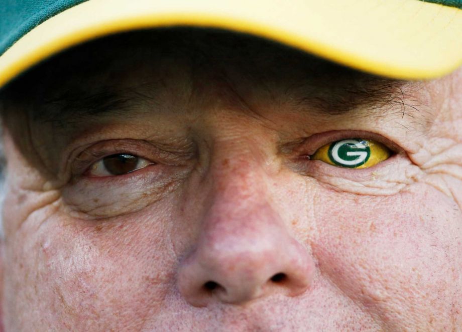 Green Bay Packers fan shows off his prosthetic eye before an NFL football game against the Seattle Seahawks Sunday Sept. 20 2015 in Green Bay Wis