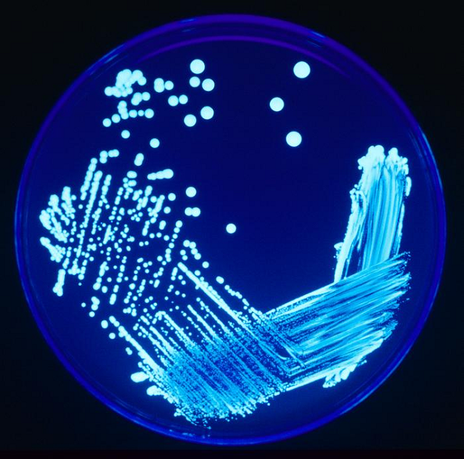 New Legionnaires' Disease Cluster Found In The Bronx