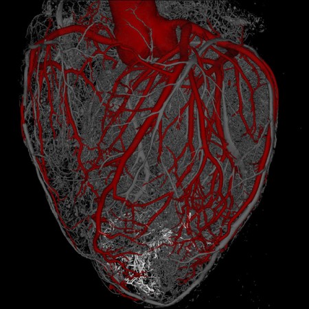 Protein patch could help tissue recovery after a heart attack