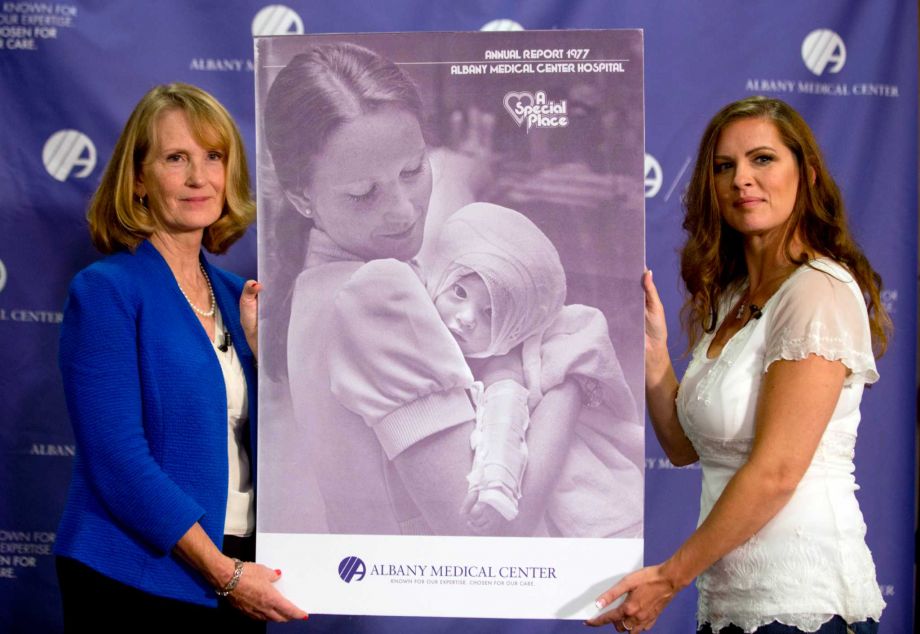 Nurse Susan Berger left and Amanda Scarpinati pose with a copy of a 1977 Albany Medical Center annual report during a news conference at Albany Medical Center Tuesday Sept. 29 2015 in Albany N.Y. Scarpinati who suffered severe burns as an infant