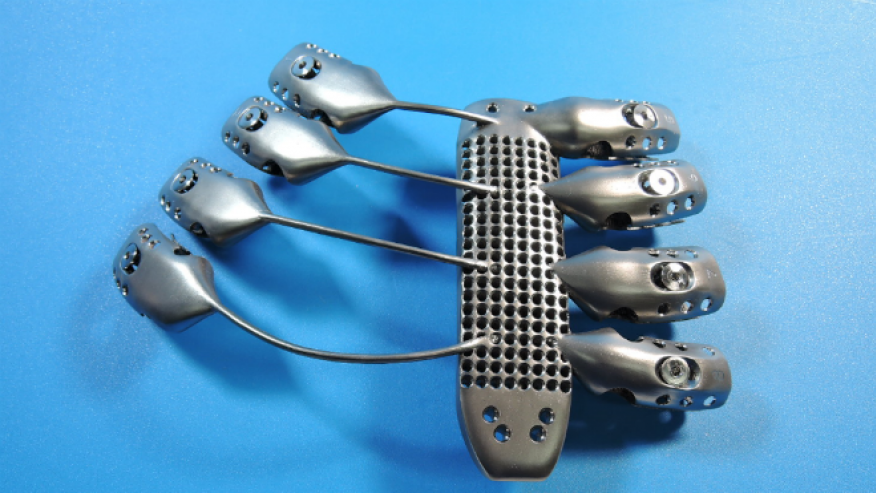 CSIRO uses to 3D printing to create new ribs for cancer patient