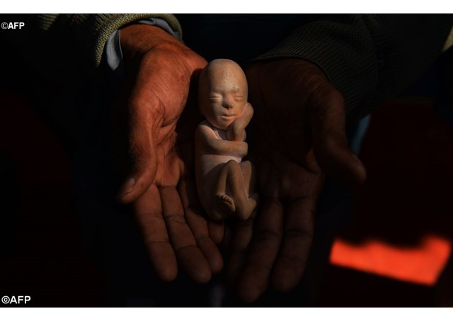 A model of a foetus- AFP