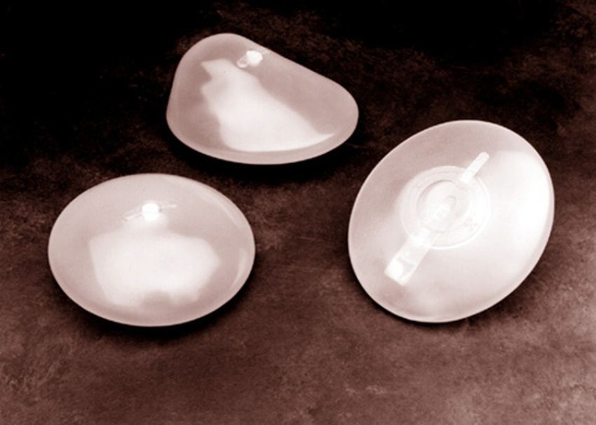 Silicone implants