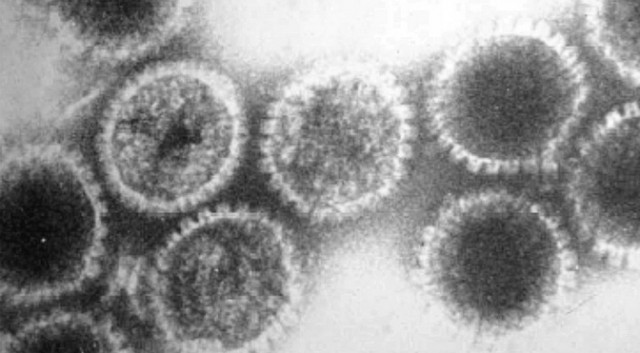 Herpes_virus00