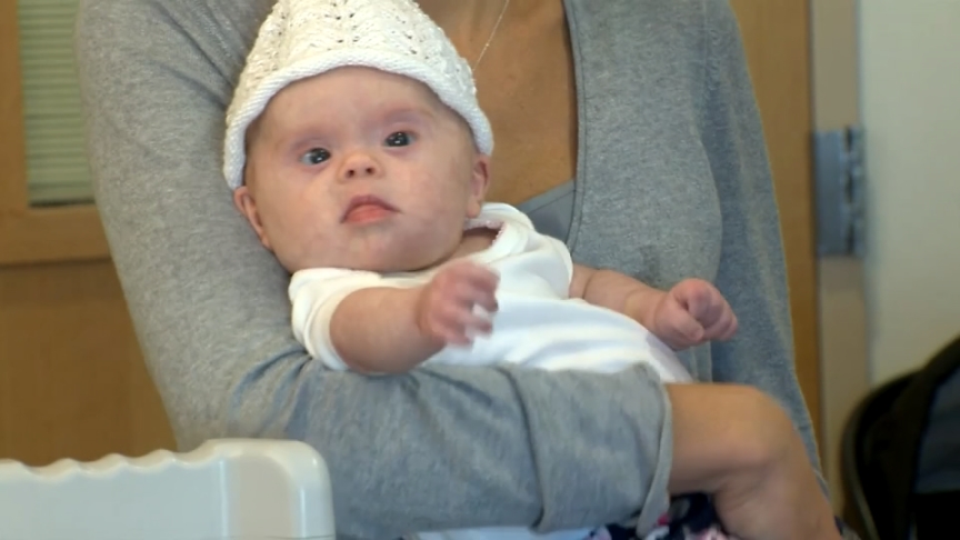 Baby with 'inoperable&#39 brain tumor is going to live doctor says