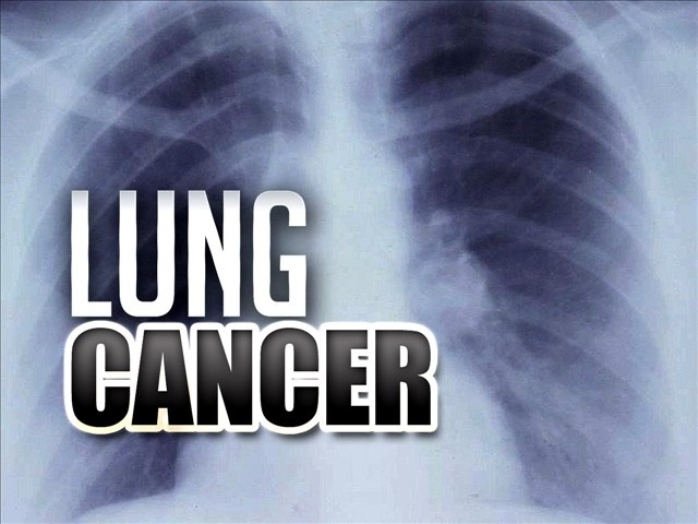 FDA expands Merck drug's approval to treat lung cancer