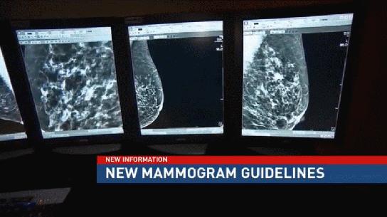 American Cancer Society says start mammograms at 45, not 40