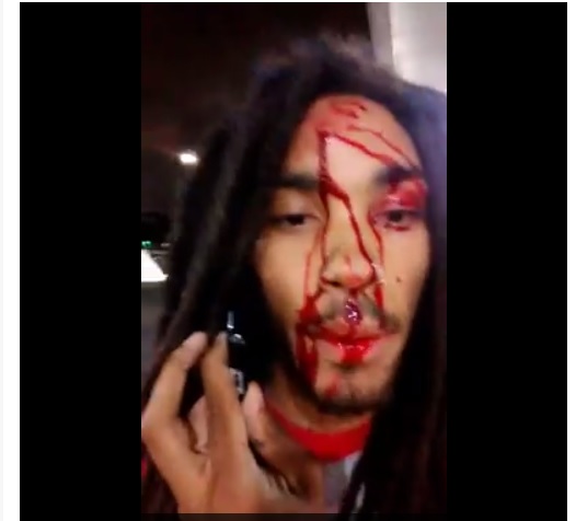 Rapper gets 'shot in the head', immediately posts video on Facebook