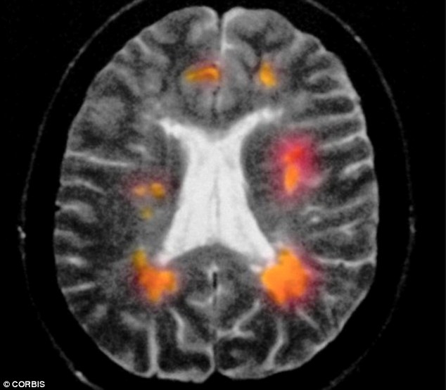 A new drug for multiple sclerosis dramatically slows the progression of the disease. Described as a ‘game changer’ by scientists ocrelizumab is the first ever drug shown to effectively treat the 10 per cent of patients with the primary progressive