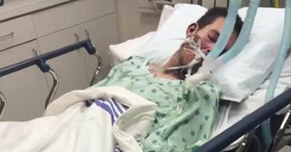 Evan Spahlinger in coma after e-cigarette exploded in his face