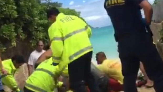 44-year-old man being treated after being attacked by a shark in Hawaii.         
                                     CBS affiliate KGMB