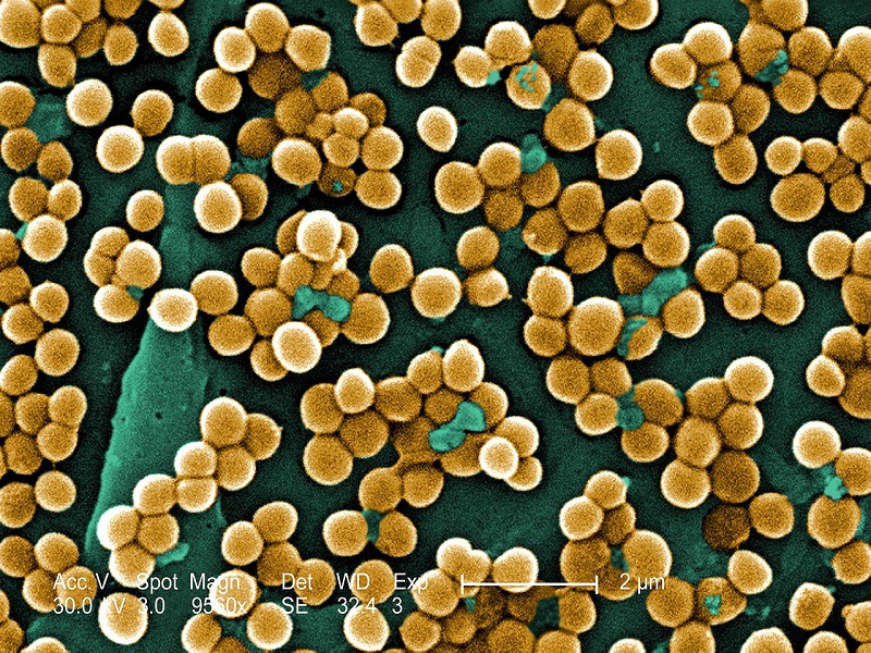 Superbugs or MRSA