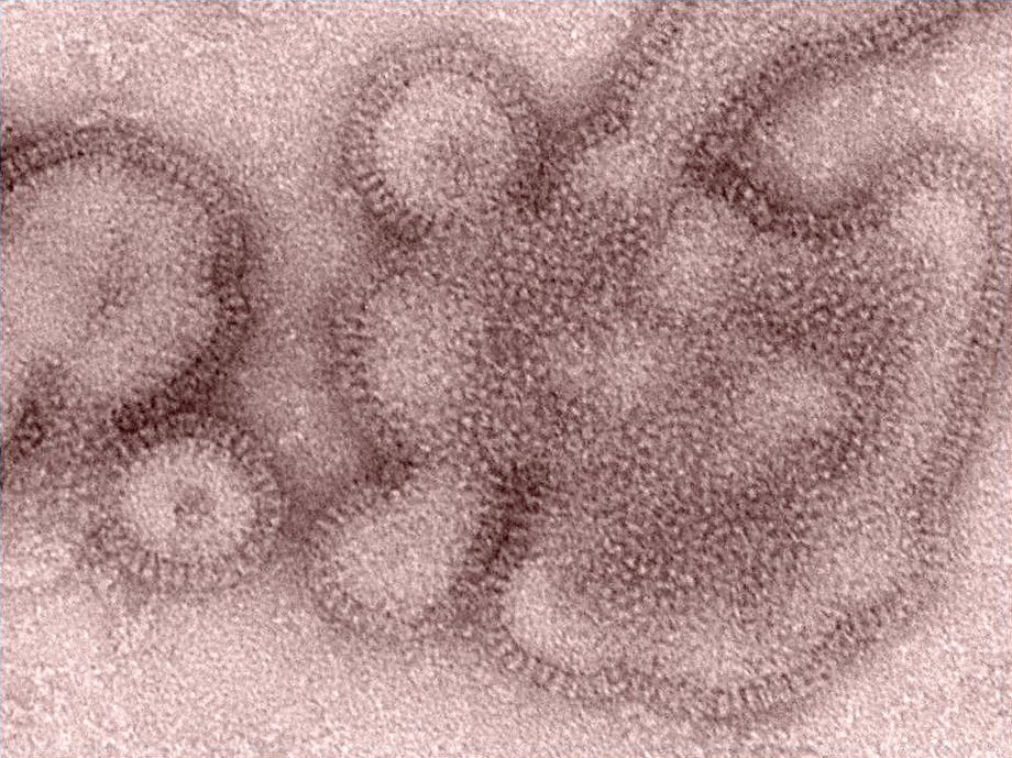 Centers for Disease Control and Prevention shows an H3N2 influenza virus the same type of flu that was responsible for most flu illnesses that winter. The California Department of Public Health announced the first flu