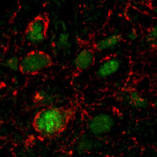 These are neurons in the rat central amygdala activated by E. coli proteins in stationary phase and surrounded by nerve terminals originating from anorexigenic brainstem projections